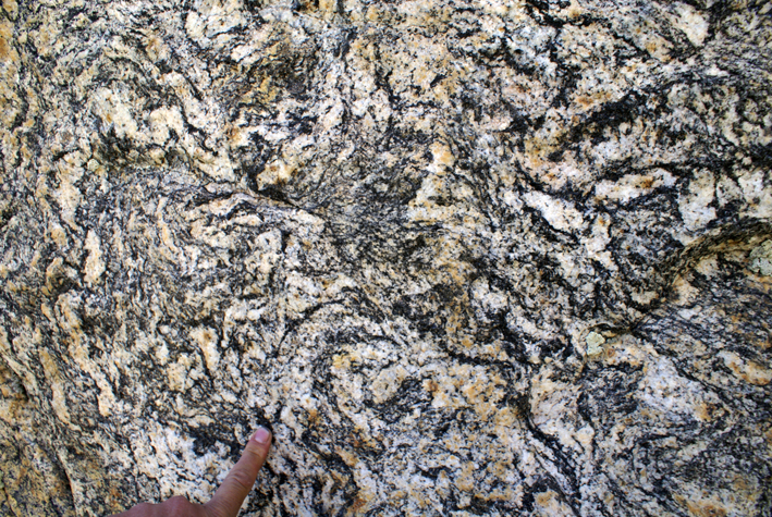 Constrictional Deformation